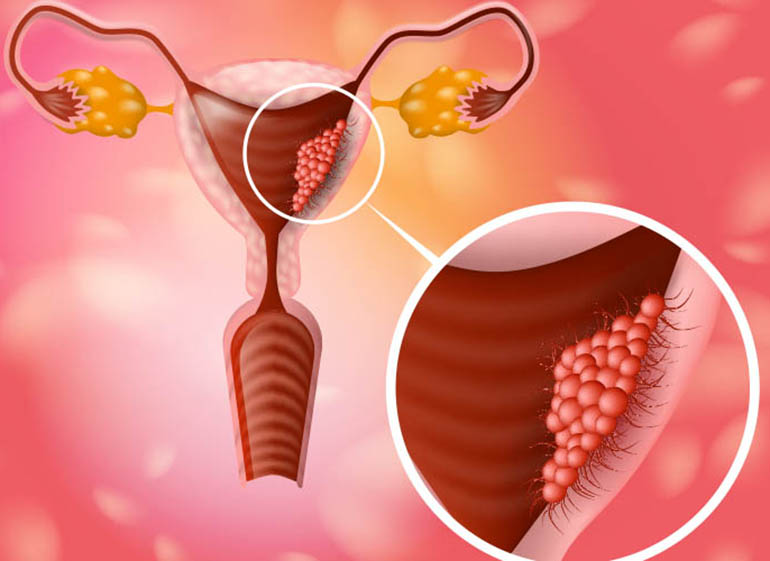 HPV Aşısı Neden Önemli? Serviks Kanseri ve Daha Fazlasına Karşı Koruyucu Güç